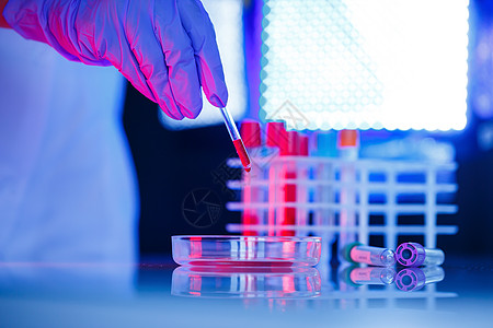 医学专家 实验室助理 医生在实验室进行分析 使用试管 移液器和培养皿来检测人体中细菌的存在诊断盘子教育化学品实验管子液体微生物学图片