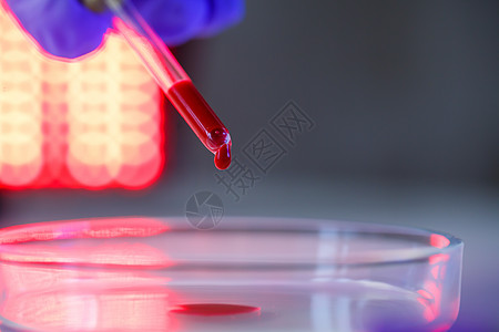 医学专家 实验室助理 医生在实验室进行分析 使用试管 吸管和培养皿来检测人体中细菌的存在 选择性焦点诊断科学家样本测试盘子成人生图片