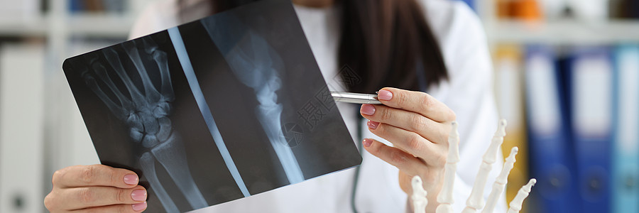 医生创伤学家检查X射线和手臂伤缝合图片