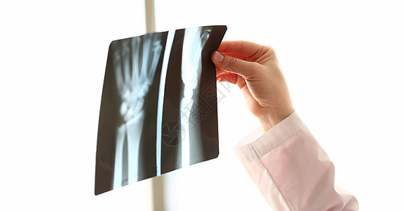 矫形医生检查X光手的图象图片