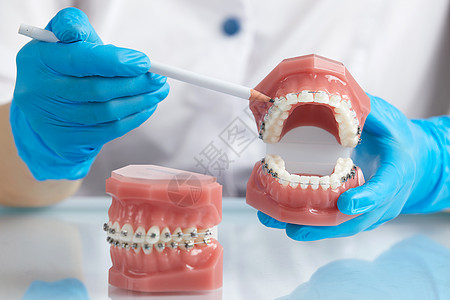 矫形医生展示人类下巴的模型 配有铁丝牙套和导线师解释差异制品示范口服治疗陶瓷牙医办公室塑料诊所牙齿图片