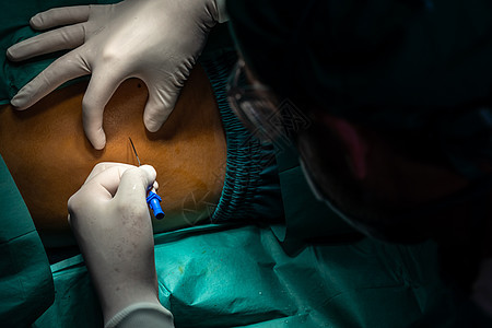 外科医生在手术前用消毒注射器向病人注射麻醉剂保健卫生治疗专家药品手套操作药物治疗医院疾病图片