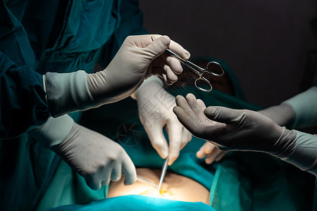 手术队的外科手术图象显示 护士会伸出消毒剪刀房间麻醉医院团队蓝色男人操作病人手套服务图片