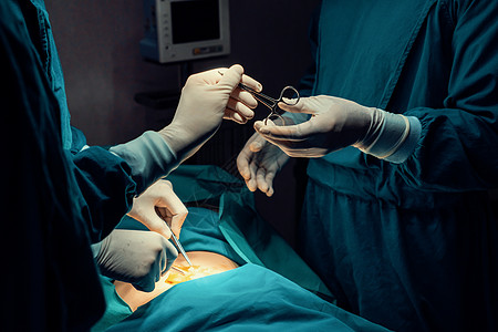 手术队的外科手术图象显示 护士会伸出消毒剪刀情况房间手套服务男人医生医院蓝色病人医疗图片