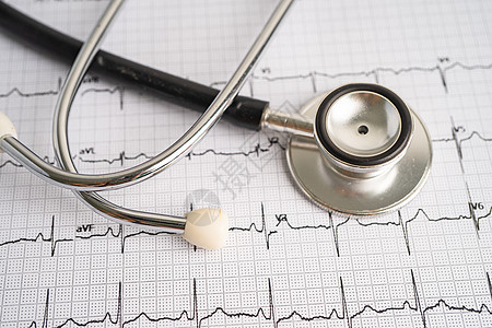 心电图ECG 心脏波 心脏病发作 心血管X光镜报告工具专家生活医院攻击桌子心脏病学预防脉冲药品图片
