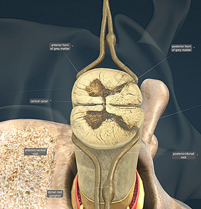 滑动盘也可以称为折叠或嵌入盘片脊椎脊髓治疗科学整形医生解剖学神经教育骨科图片