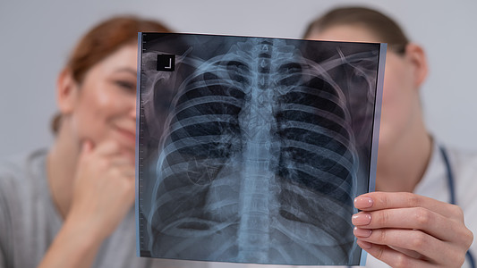 医生咨询一名天主教妇女 并对肺部X光片进行评论保健肺炎诊所卫生病人药品医院女性检查胸部图片