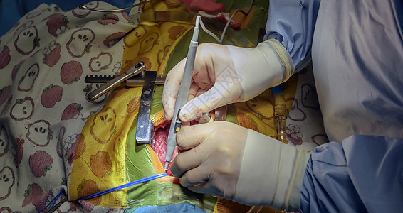 罗斯的手术是动脉阀门缺陷的外科治疗动脉瘤主动脉剧院程序手臂维修房间医院瓣膜工具图片
