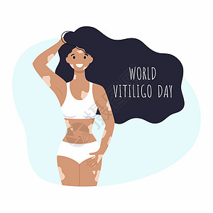 6月25日的录制世界维利哥节 一位女性有维利戈 关于罕见疾病主题的矢量插图 在六氯丁二烯中皮肤斑点海滩泳装老年斑医生病人数字女士图片