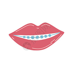 手绘嘴唇与牙齿和卡通扁平风格的牙套 正畸保健概念的矢量插图 贴纸的口腔卫生 网页设计 海报 明信片 织物印刷图片