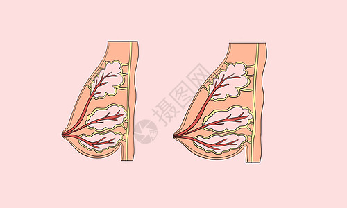 乳腺女性丰胸设计图片
