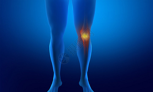 受伤骨折腿科技感大图高清图片