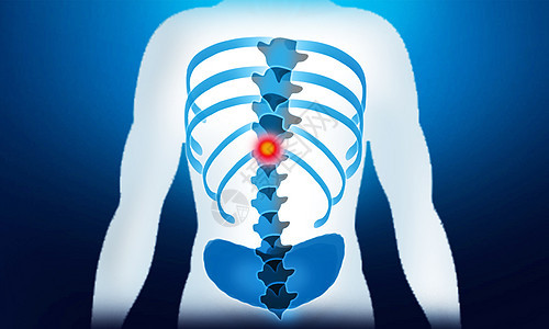 脊椎疼痛背景图片