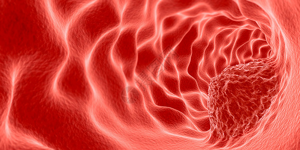 红血球肿瘤癌症设计图片