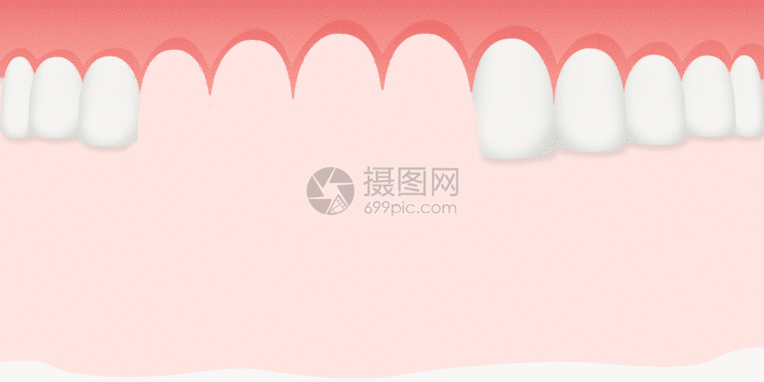 种植牙齿gif动图图片 正版gif素材 摄图网