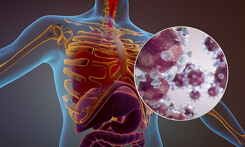 人体肺部病毒X光片背景图片