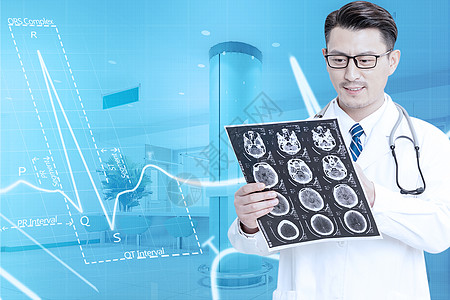 脑CT片医疗科技设计图片