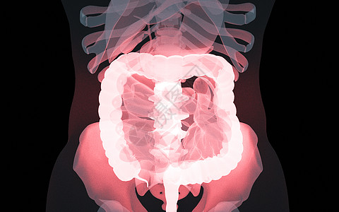 肠道病人体肠道疾病设计图片