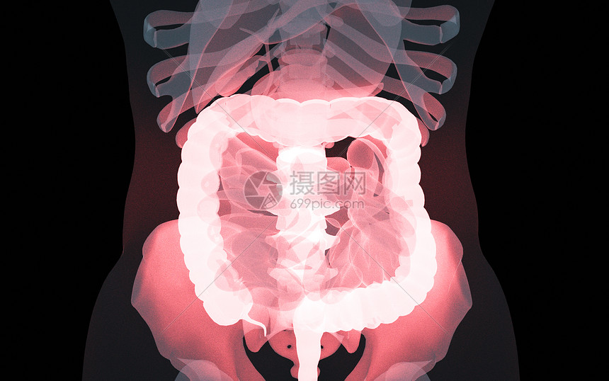 人体肠道疾病图片