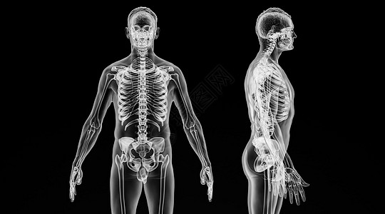 四肢X光人体骨骼场景设计图片