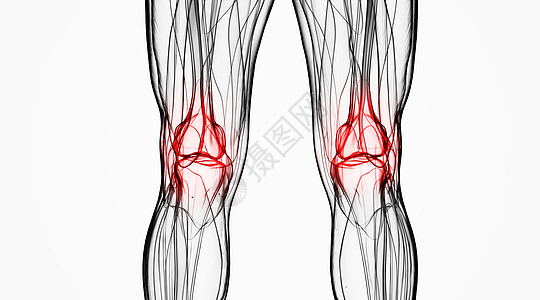 髌骨X光关节炎场景设计图片