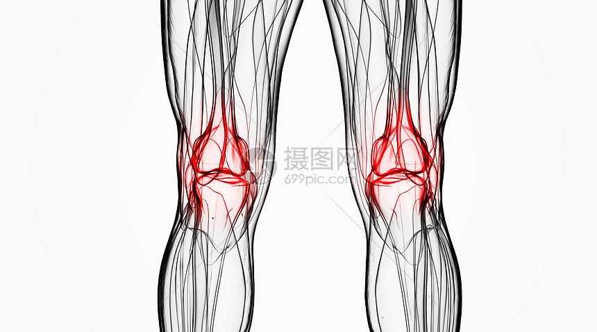 X光关节炎场景图片