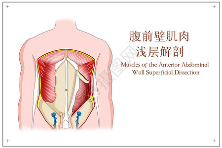 腹前壁肌肉浅层解剖医疗插画背景图片