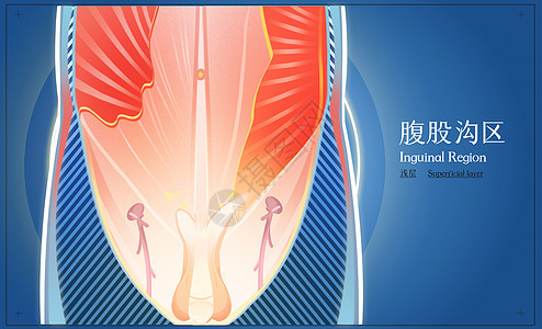 男性腹股沟区浅层医疗插画背景图片