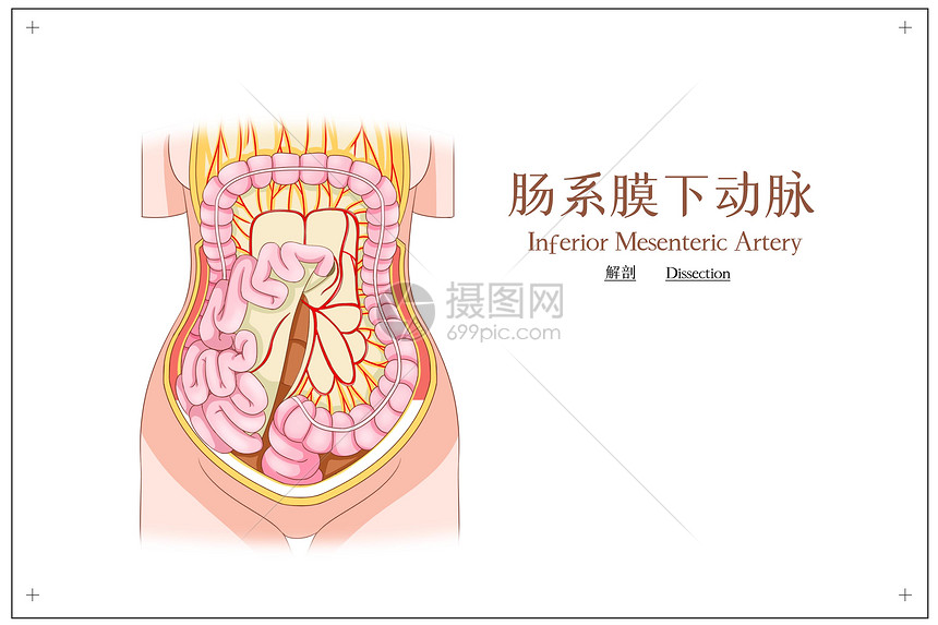 肠系膜下动脉插画图片下载 正版图片 摄图网 肠系膜下动脉插画图片下载 正版图片 摄图网