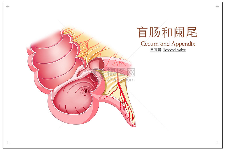盲肠和阑尾回盲瓣医疗插画插画图片下载 正版图片 摄图网 盲肠和阑尾回盲瓣医疗插画插画图片下载 正版图片 摄图网