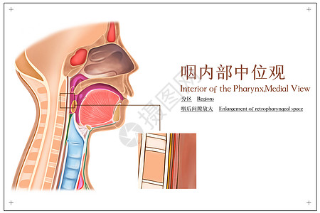 喉咙咽内部中位观分区和咽后间隙医疗插画插画