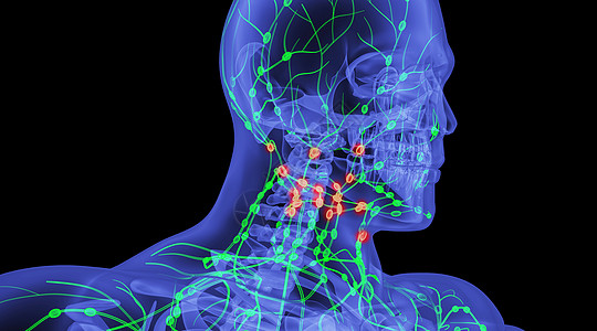 淋巴系统人体淋巴病变场景设计图片