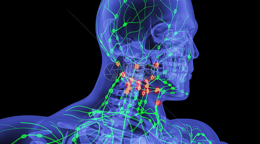 人体淋巴病变场景图片