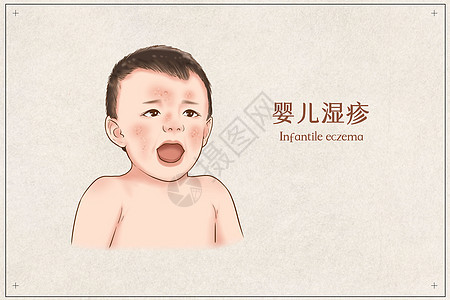 婴儿湿疹医疗插画示意图图片