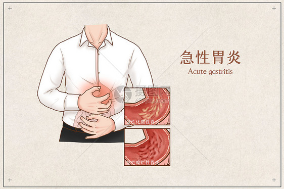 急性胃炎医疗插画图片