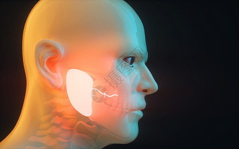 人体腮腺疾病高清图片