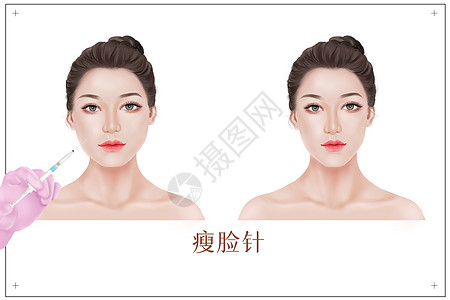 整形美容美女医学整形瘦脸对比插画插画