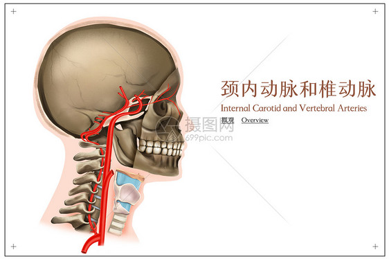 颈内动脉和椎动脉的概观医疗插画图片