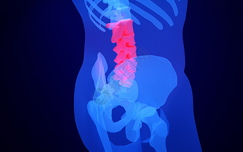 人体腰椎骨图片