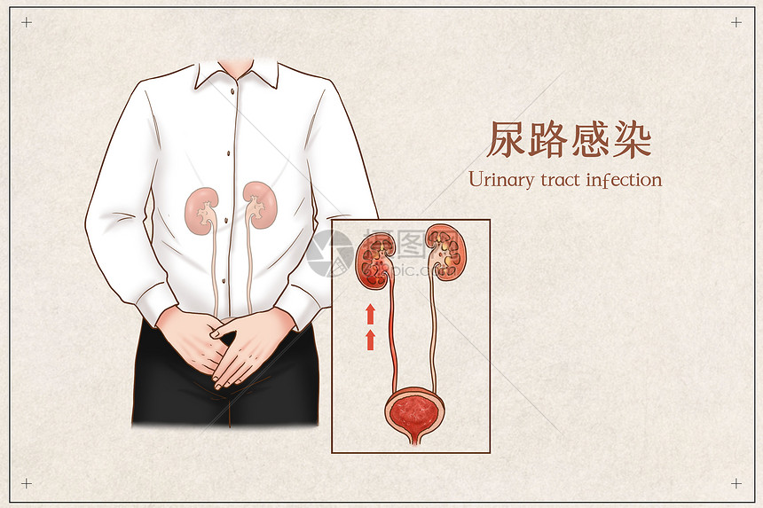 尿路感染医疗插画插画图片下载-正版图片401793635-摄图网