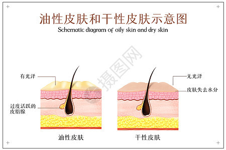 油性皮肤和干性皮肤示意图图片