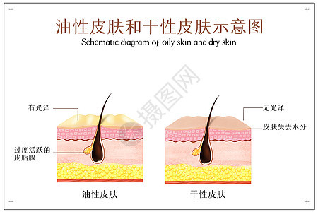 油性皮肤和干性皮肤示意图背景图片