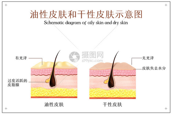 油性皮肤和干性皮肤示意图图片