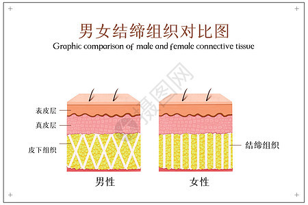 男女结缔组织对比图背景图片