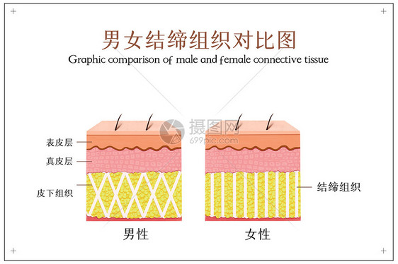 男女结缔组织对比图图片