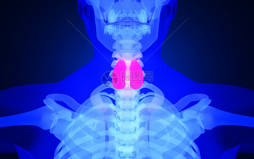 人体甲状腺疾病图片