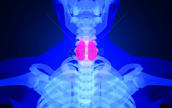 人体甲状腺疾病图片