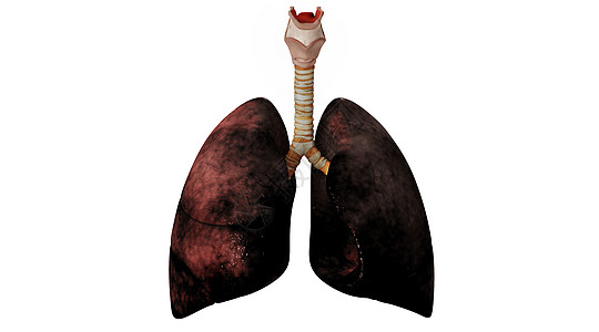 肺部病变场景高清图片