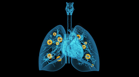 呼吸系统肺部病变场景设计图片