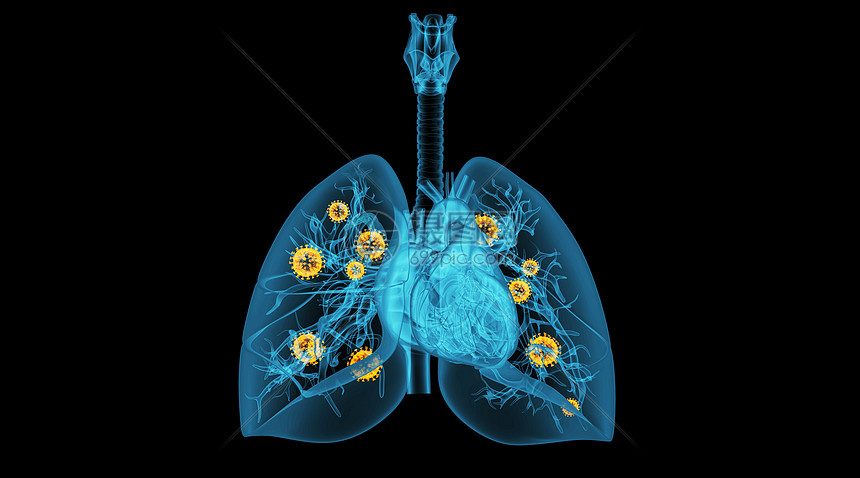 肺部病变场景图片